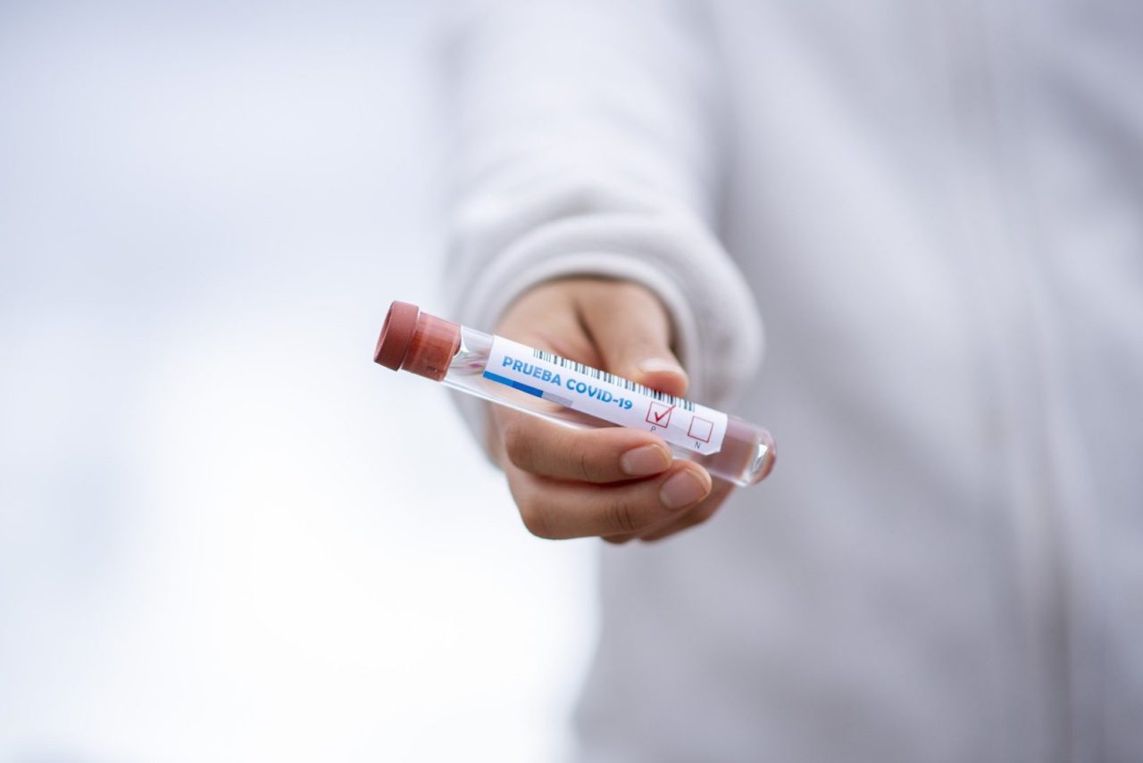 coronavirus sperimentazione