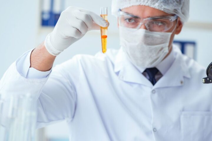 urine e1652800507205