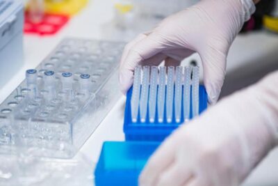 laboratorio covid afp