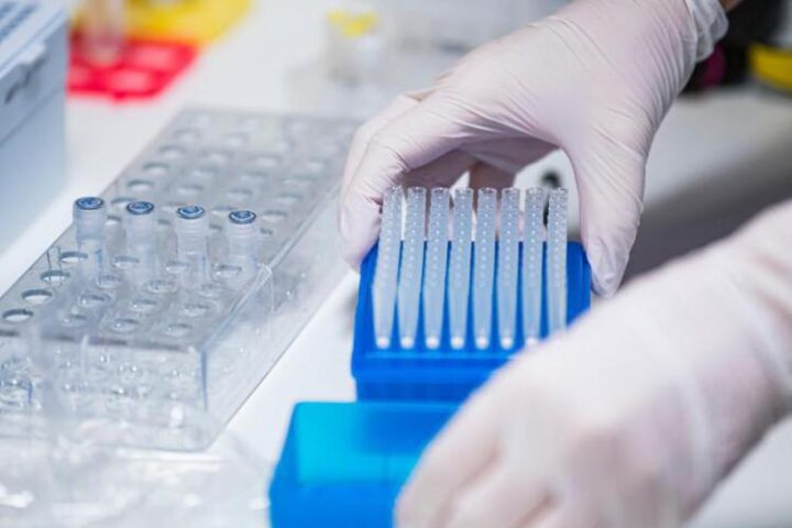 laboratorio covid afp