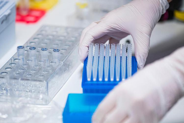 laboratorio covid afp